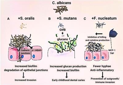 Fungal footprints in oral cancer: unveiling the oral mycobiome